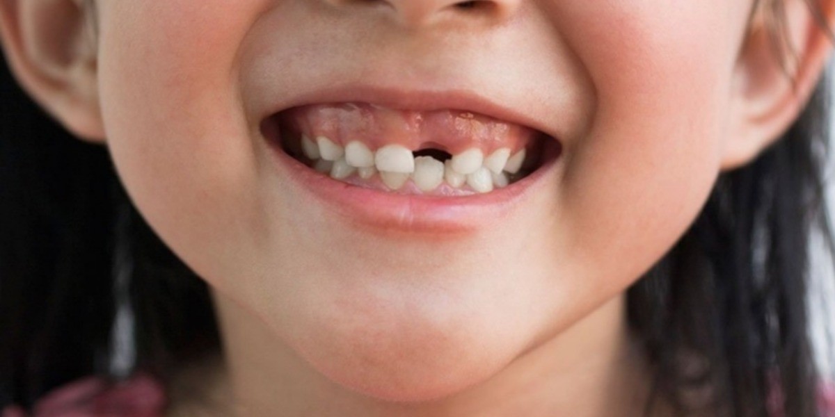 Guardar los dientes de leche de tu hijo podría salvarle la vida