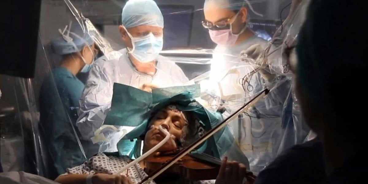 Toca el violín mientras le extirpan un tumor cerebral
