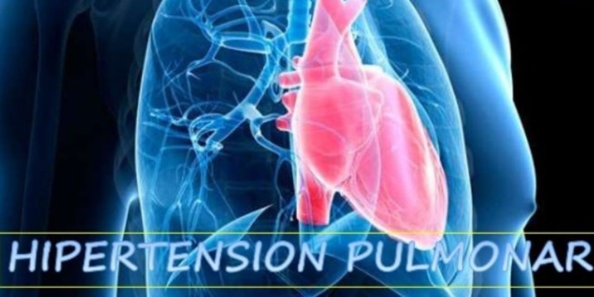Cómo diferenciar la hipertensión arterial pulmonar del Covid-19