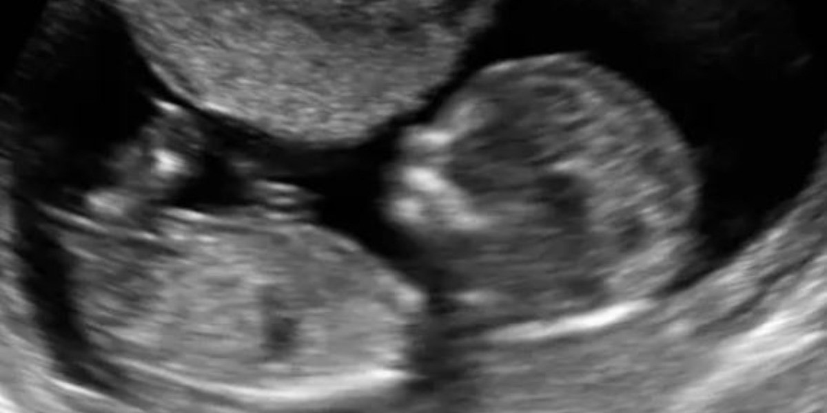 Abren debate a la despenalización del aborto en Congreso estatal