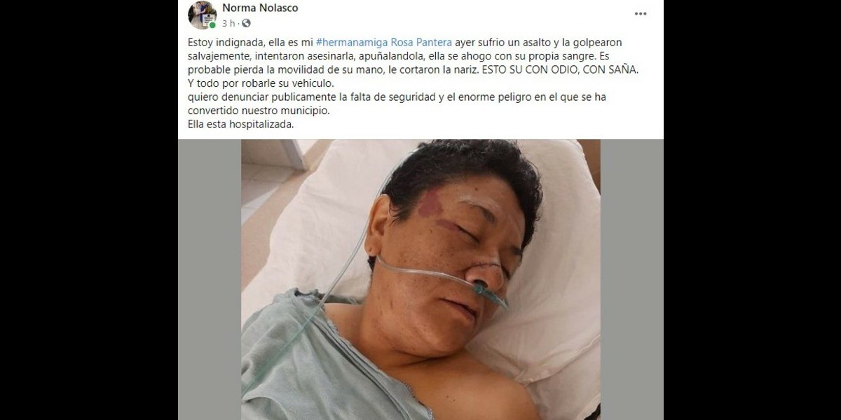 Leonesa víctima de asalto sufre severas lesiones