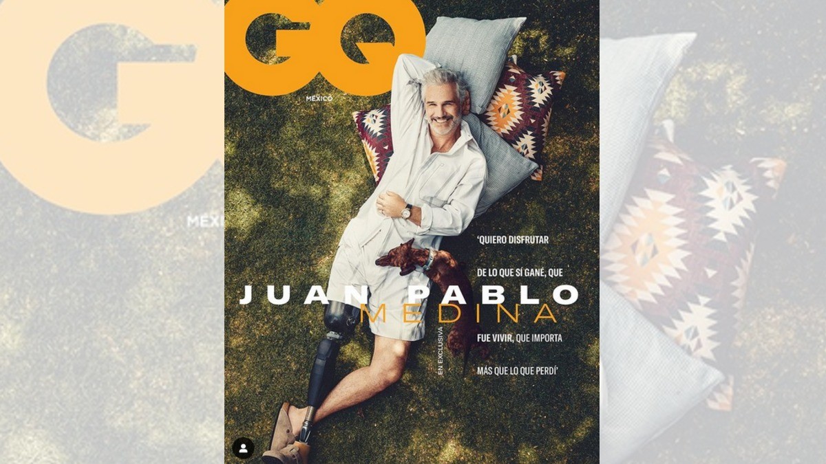 Juan Pablo Medina comparte fotos con prótesis tras sufrir una trombosis