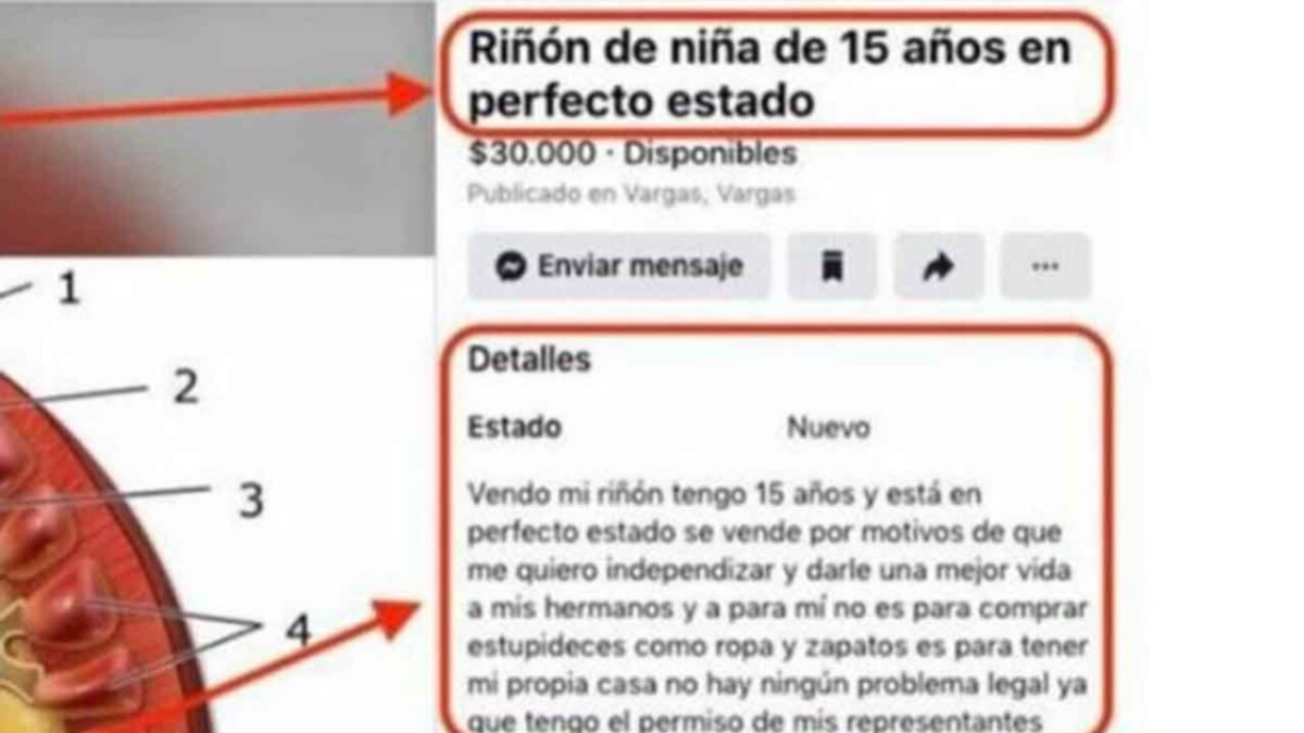 Detienen a mujer por intentar vender riñón en Facebook