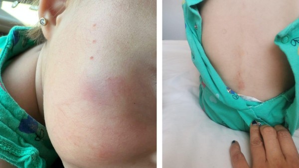 Surge otra denuncia de maltrato en una estancia infantil de León