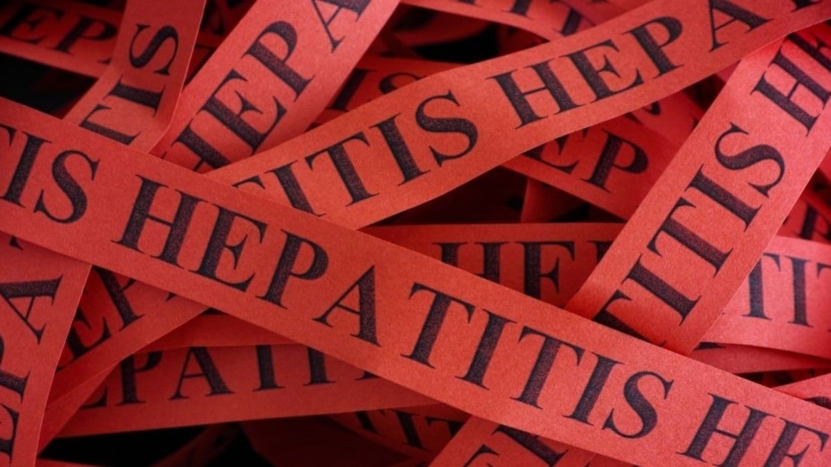 Guanajuato prende alerta por hepatitis infantil