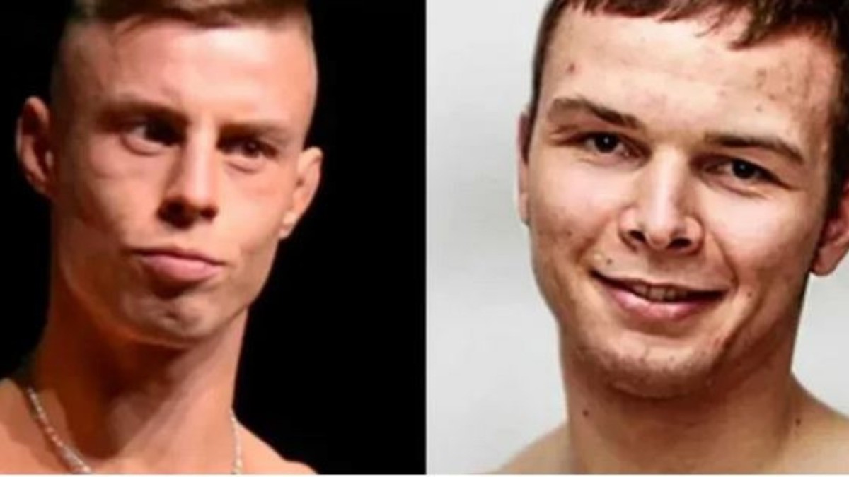 ¡¿Así quedaron?! Impactan los rostros desfigurados de luchadores MMA tras pelea