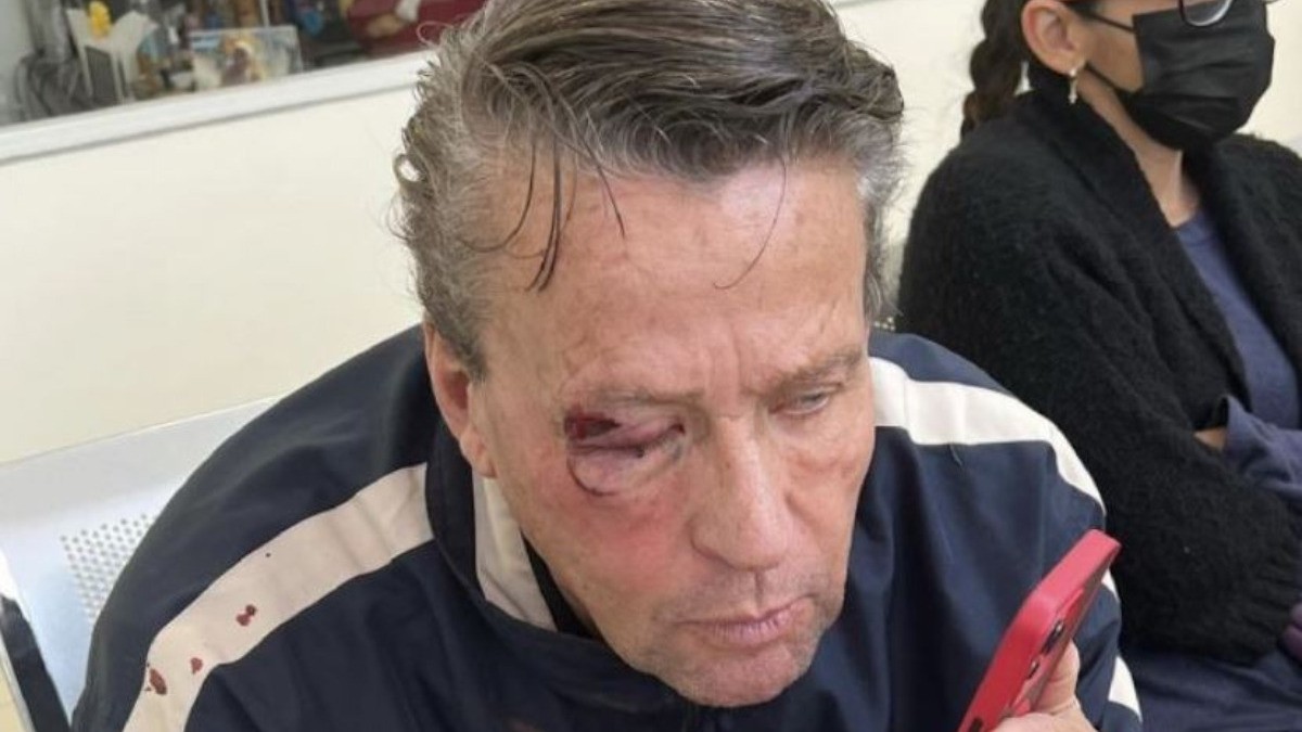 Le dan golpiza a Adame; podría perder la vista