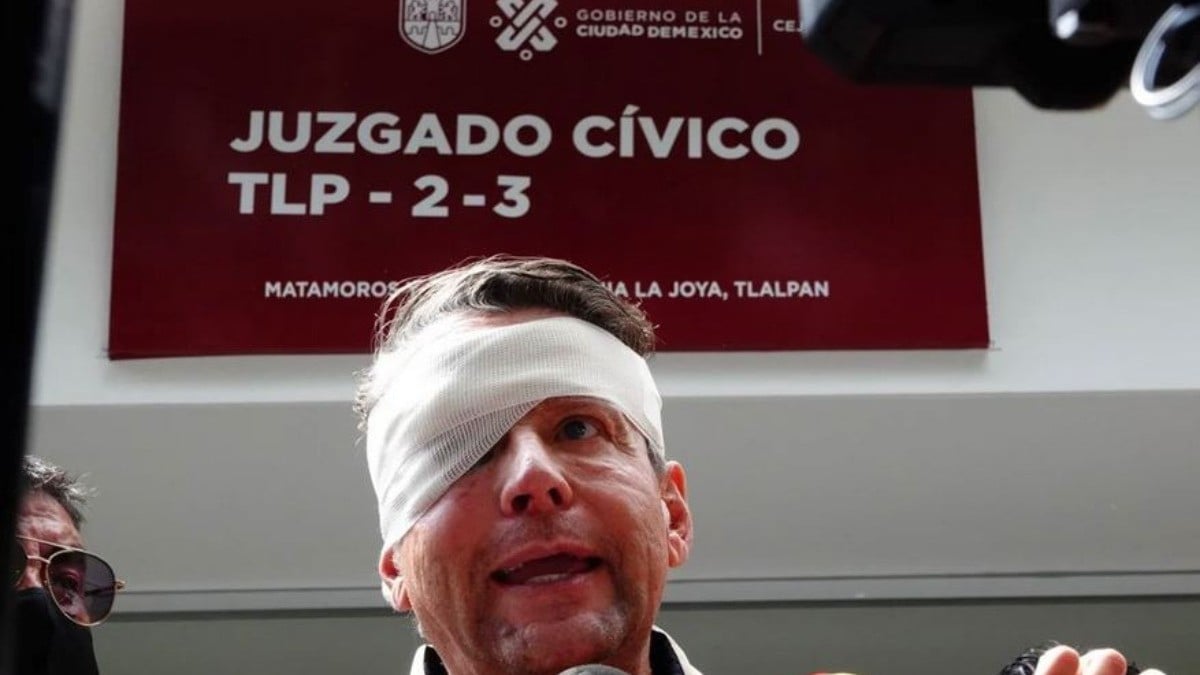 “¡Me golpearon con una piedra en el ojo!“