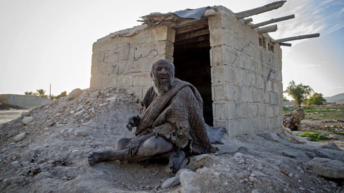 Muere el hombre más sucio del mundo ¡tras más de 60 años sin bañarse!