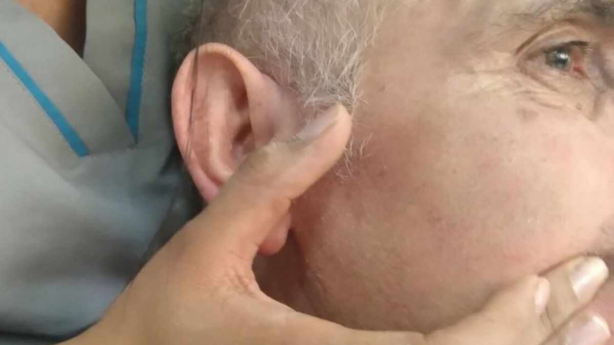 Sigue sin conocerse qué motivó parálisis facial de pacientes atendidos en el IMSS