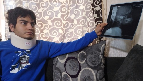 Conductor en estado de ebriedad lo arrolla y queda libre