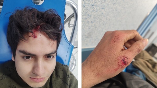 Investigan liberación de automovilista ebrio que arrolló a motociclista