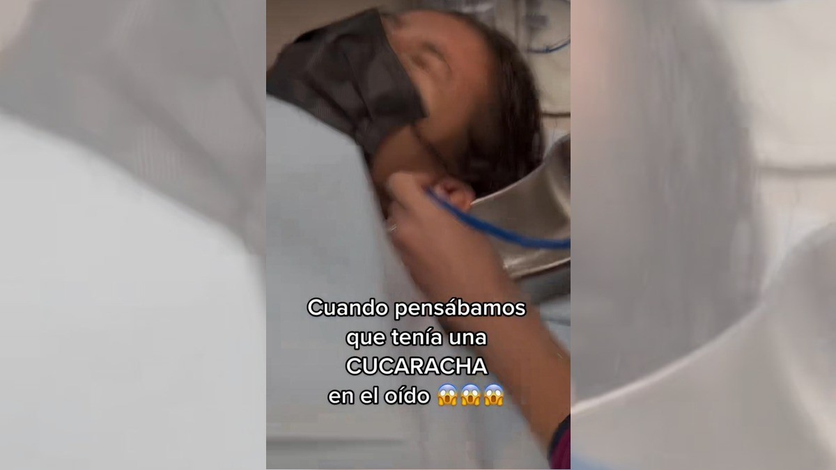 Mujer acude al doctor por molestia en el oído; ¡le encuentran un dulce!