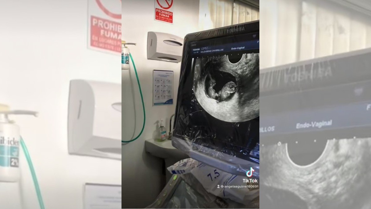 ¡Futura mamá entra en shock al enterarse de que espera gemelos!