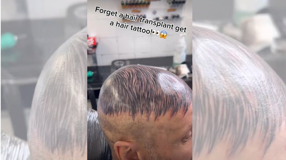 Hombre se tatúa la cabeza para disimular su calvicie