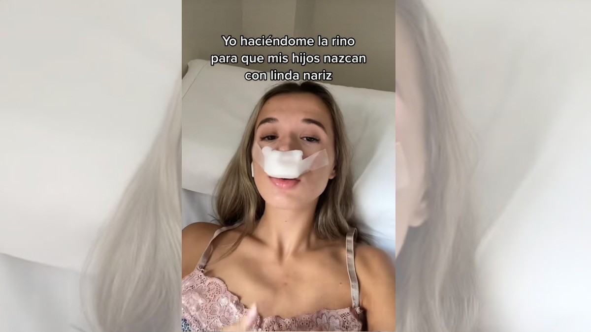 Mujer se hace rinoplastia para heredar a sus hijos una “linda nariz“
