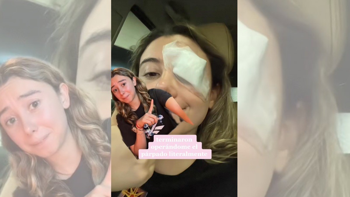 Tiktokera termina en el quirófano luego de fallido truco de belleza