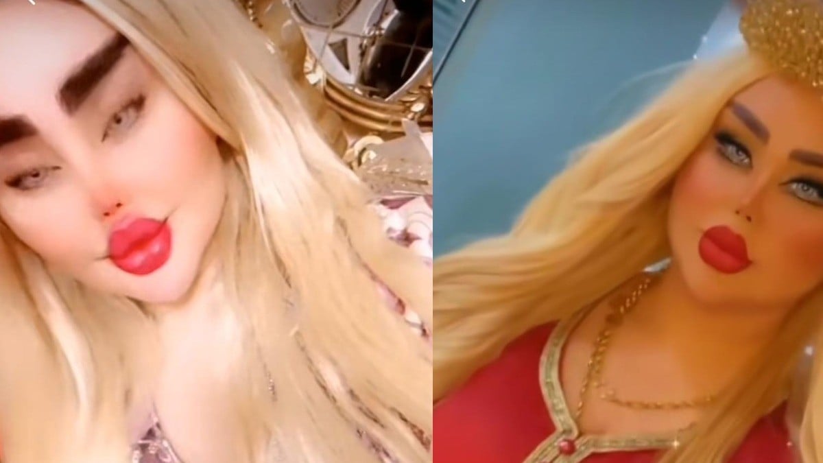 Mujer se somete a 43 cirugías para ser la “Barbie humana”