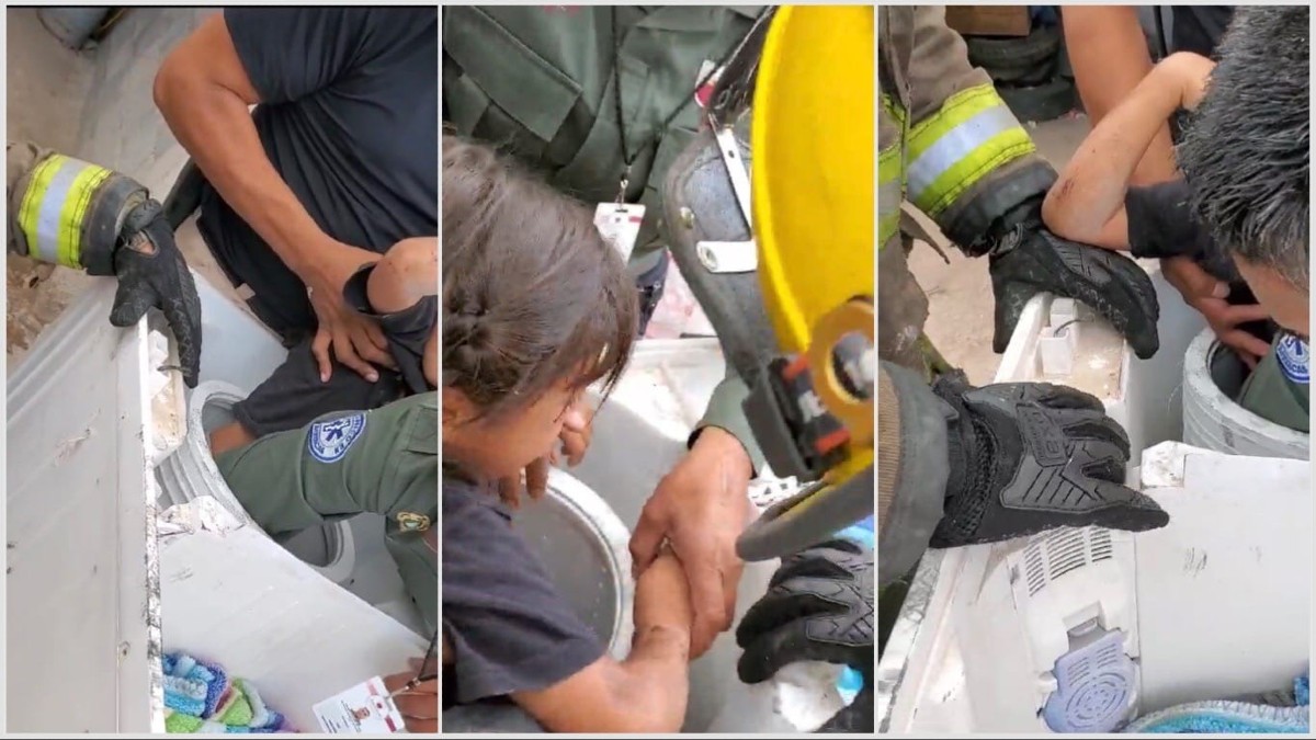 Niña queda atorada en lavadora y la fricción le quema la piel de sus piernas