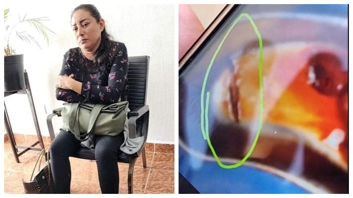 Llega a hospital por fracturas y ahora podría morir: lo operan y le dejan bisturí dentro