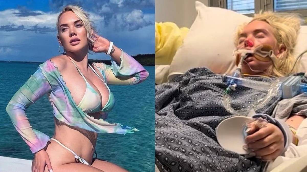 ¡Cuidado! Advierten sobre bacteria ‘come carne’ en Golfo de México