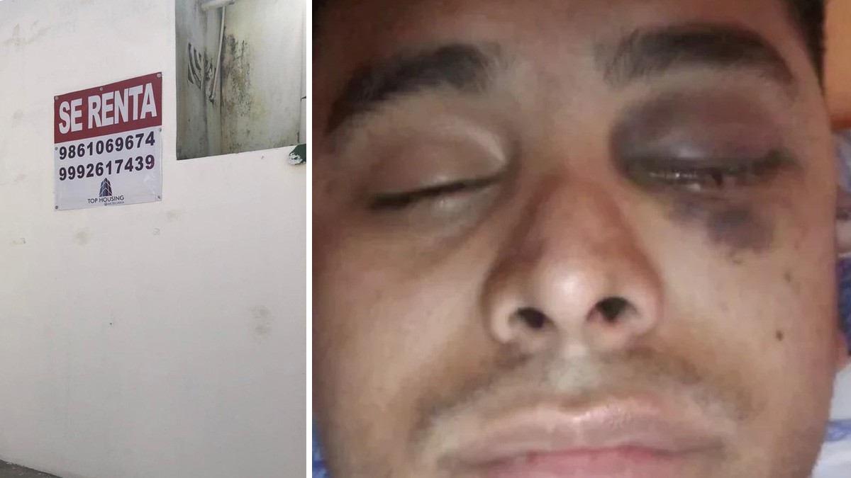 Inquilino se retrasa con la renta y el dueño lo deja sin un ojo