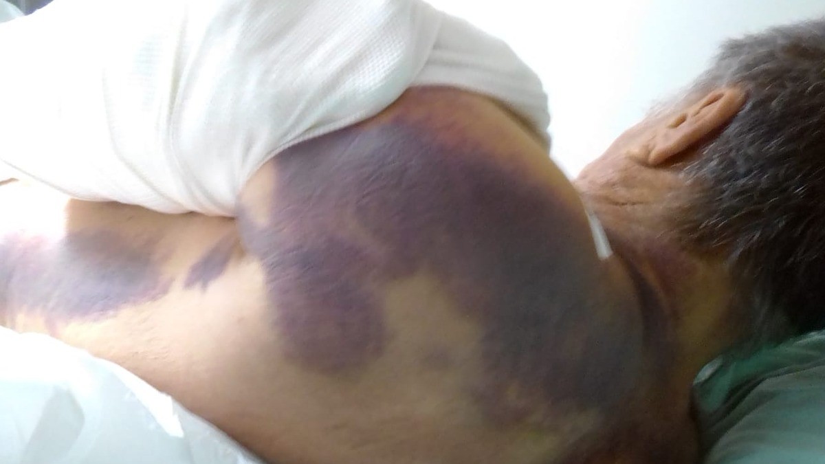 Acusa familia de adulto mayor pésima atención del IMSS