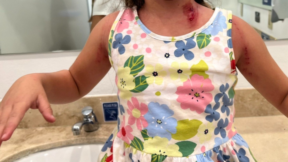 VIDEO Niña pasea en GoKarts y al salir queda herida, sangrada y con moretones