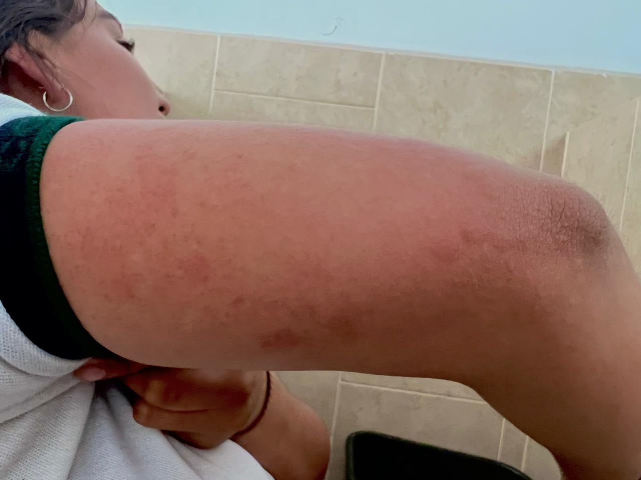 ¡Auxilio, las chinches nos invaden!, ¿qué hago?