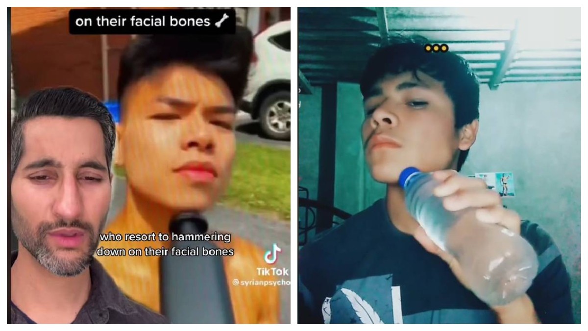 VIDEO Tendencia en Tik Tok incita a jóvenes a fracturarse el rostro a golpes “para verse mejor”