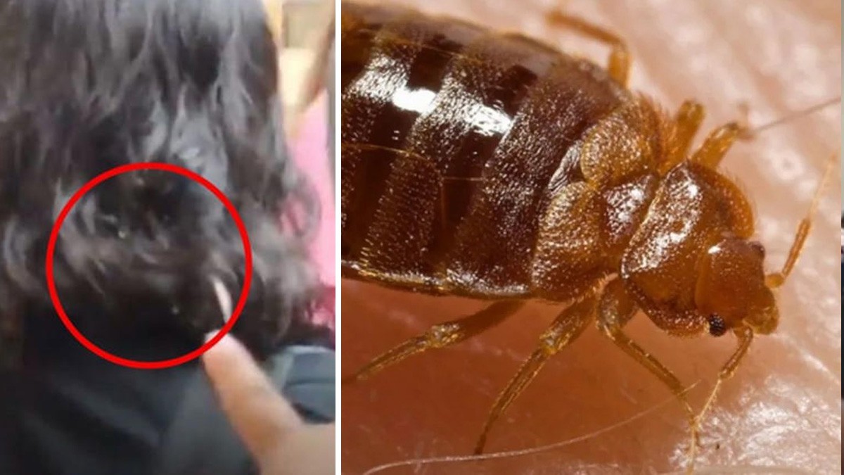 VIDEO: Captan a estudiante de la UNAM con chinches; van 8 facultades infestadas