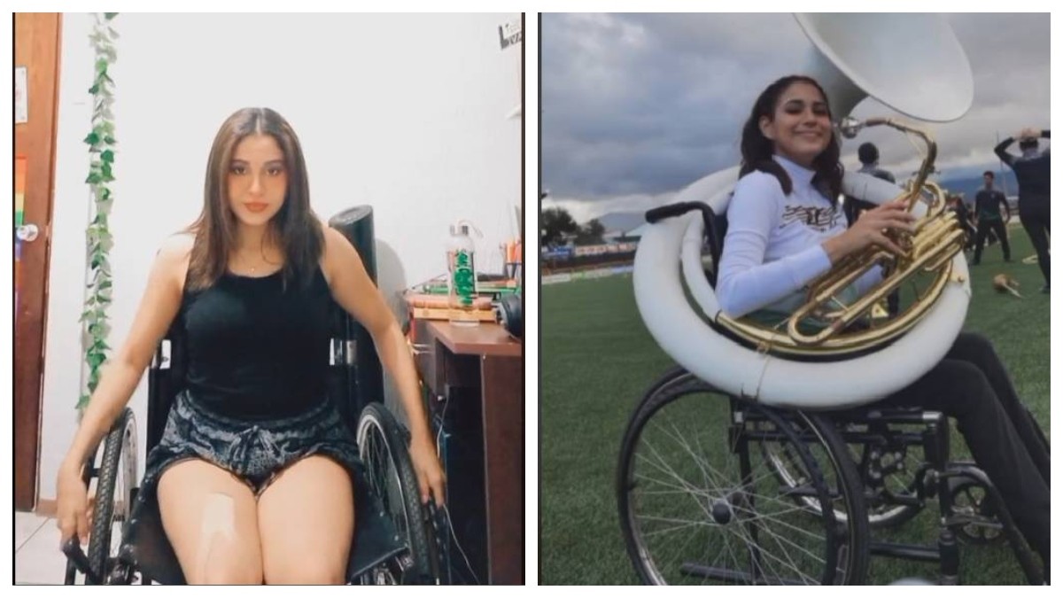 Por un piercing en la nariz, esta chica quedó parapléjica, “¡Pude morir!”