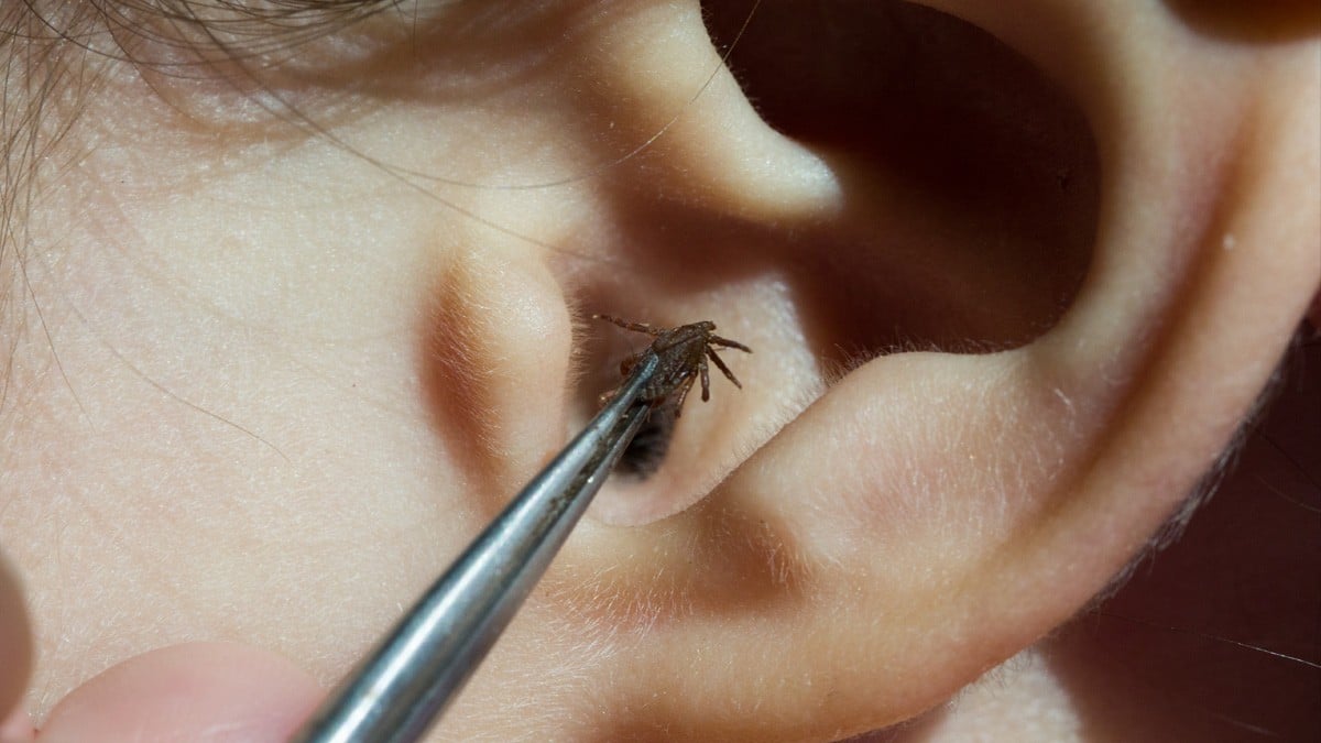 VIDEO: Mujer va al doctor por molestia y descubre que una araña vivía en su oído