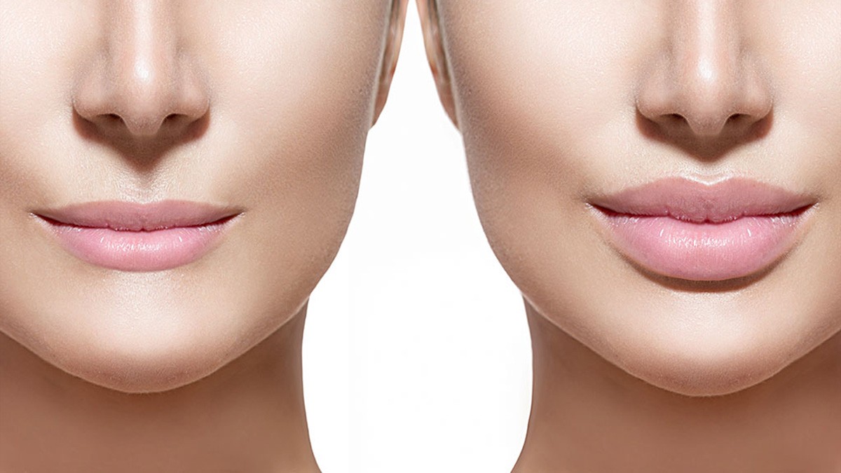 Mujer pagó 3 mil 500 pesos para operarse los labios y falleció dos semanas después