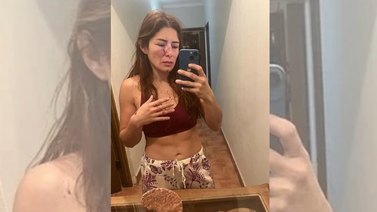“Lo que me hizo es inhumano“, denuncia luchadora golpiza de su expareja, también luchador