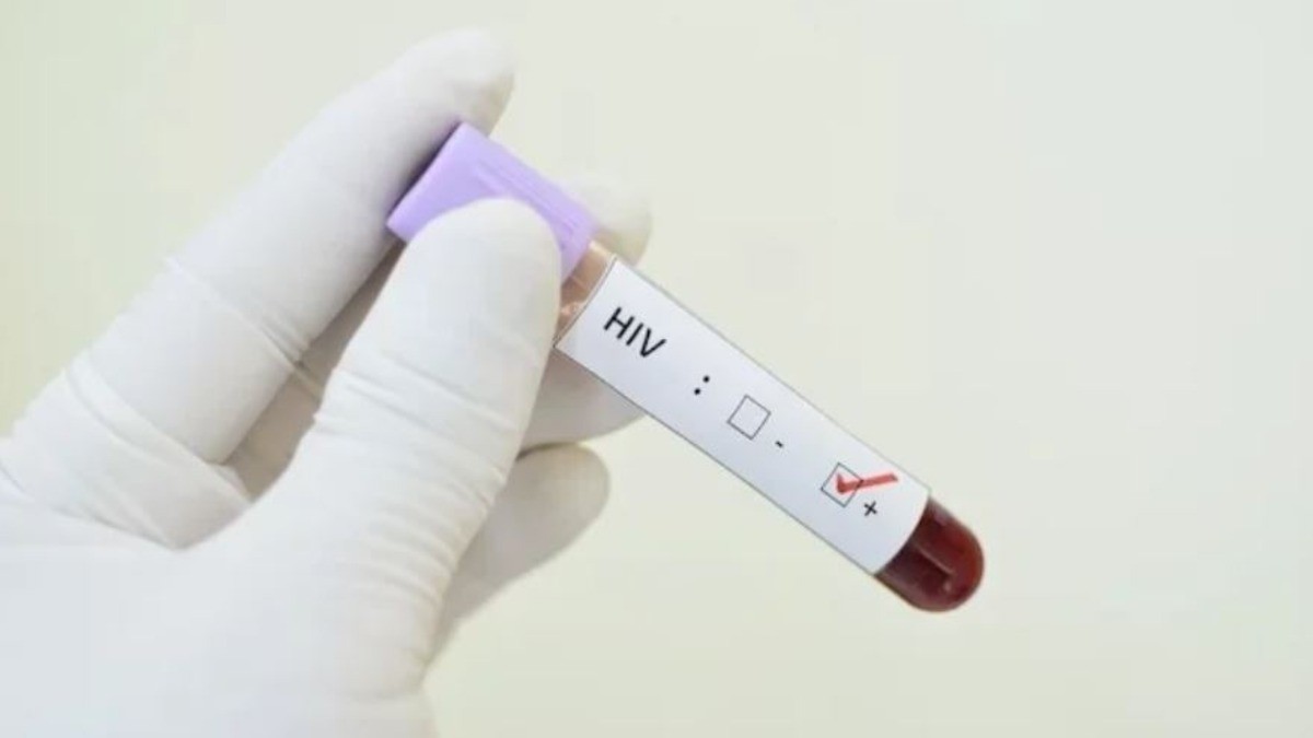 Guanajuato tiene una tarea pendiente en la atención a personas con VIH