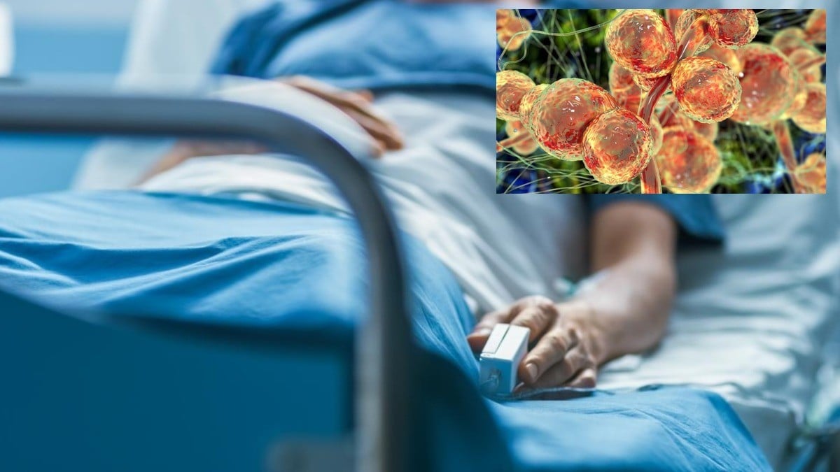 Alertan de peligroso hongo que se transmitió ya en siete hospitales