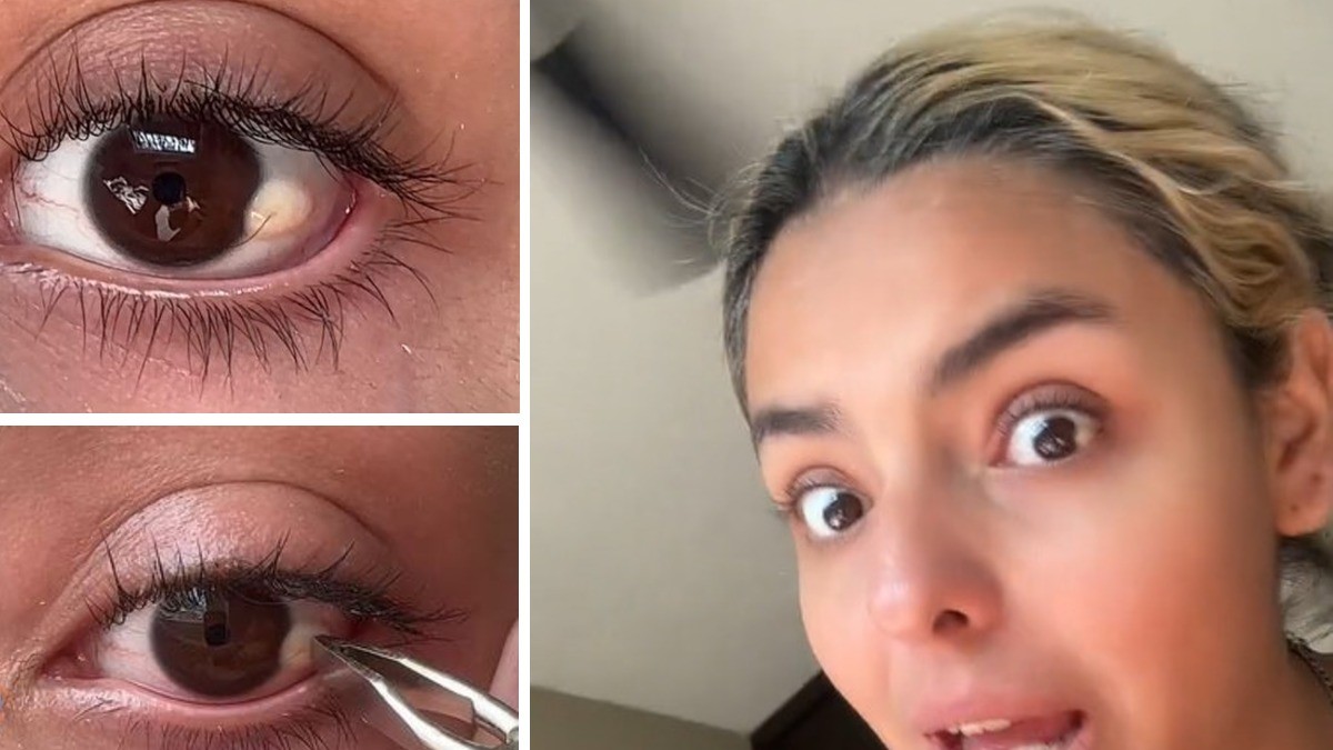 Tiktoker sorprende al mundo depilándose el globo ocular, ve cómo lo hace