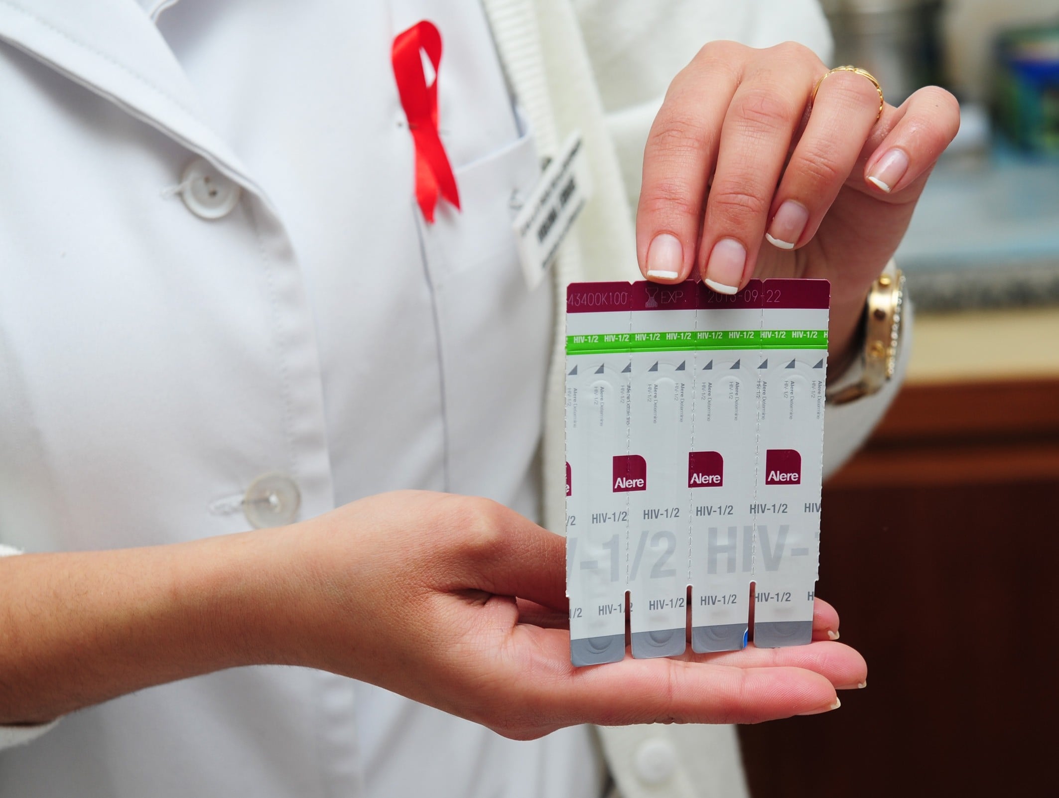 Aprueba Cofepris uso de pruebas caseras de VIH, ¿cómo funcionan?