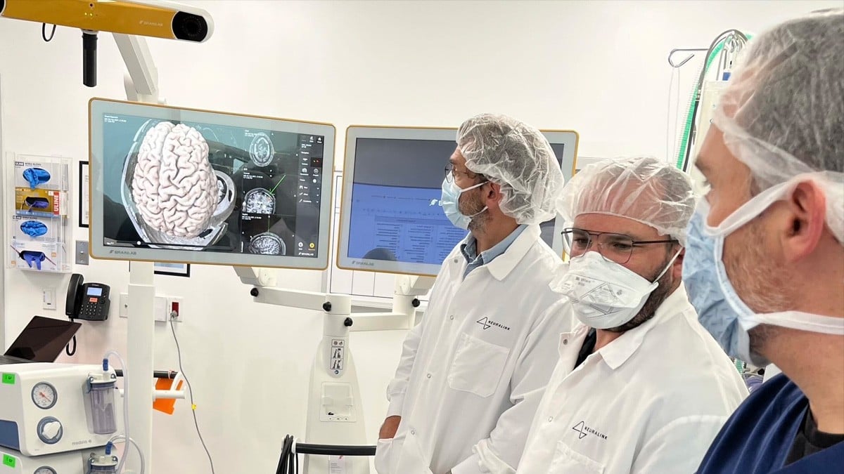 Paciente con chip en el cerebro de Neuralink ya puede mover el mouse con la mente