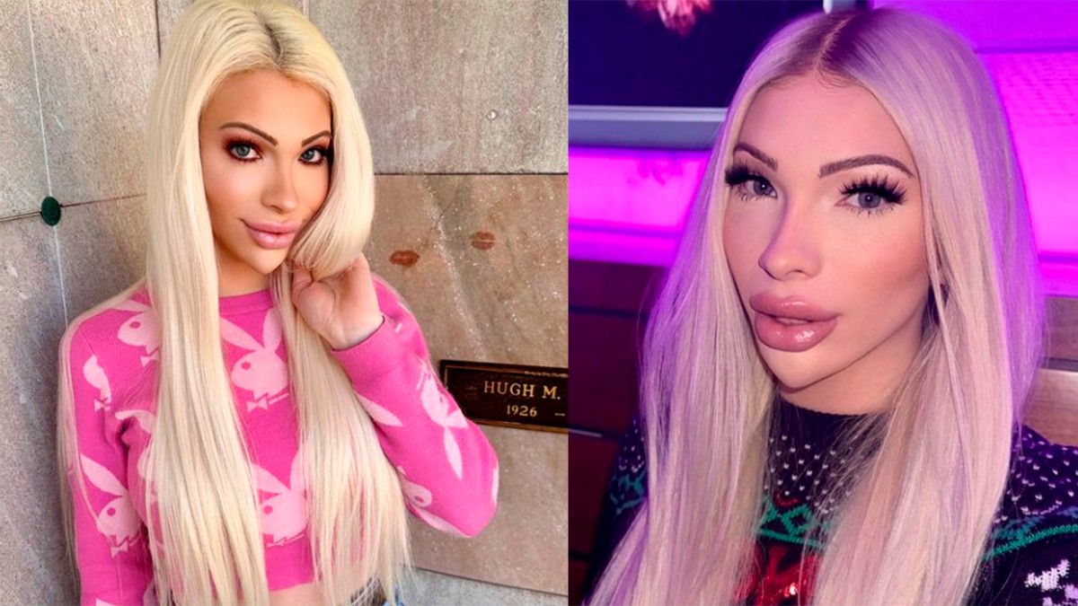 Joven gasta 50 mil dólares en cirugías plásticas y ahora desea ser más “natural”