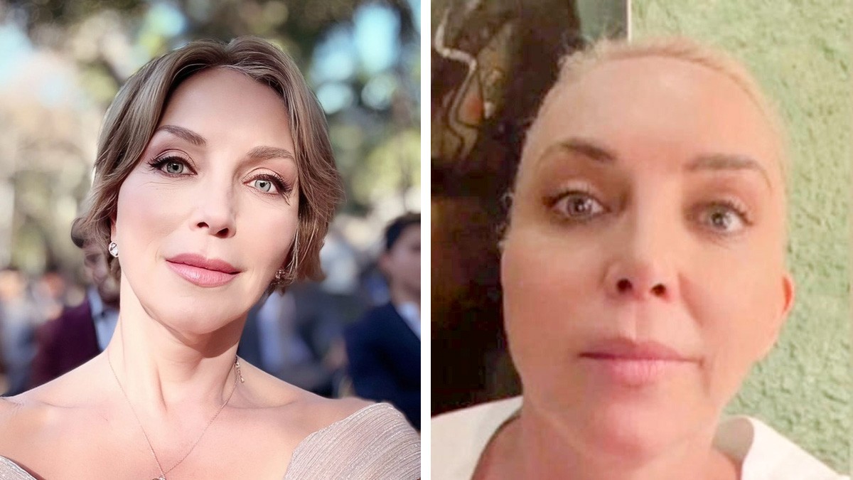 'Estoy viva de milagro', Laura Flores sufre microinfarto cerebral por tratamiento estético