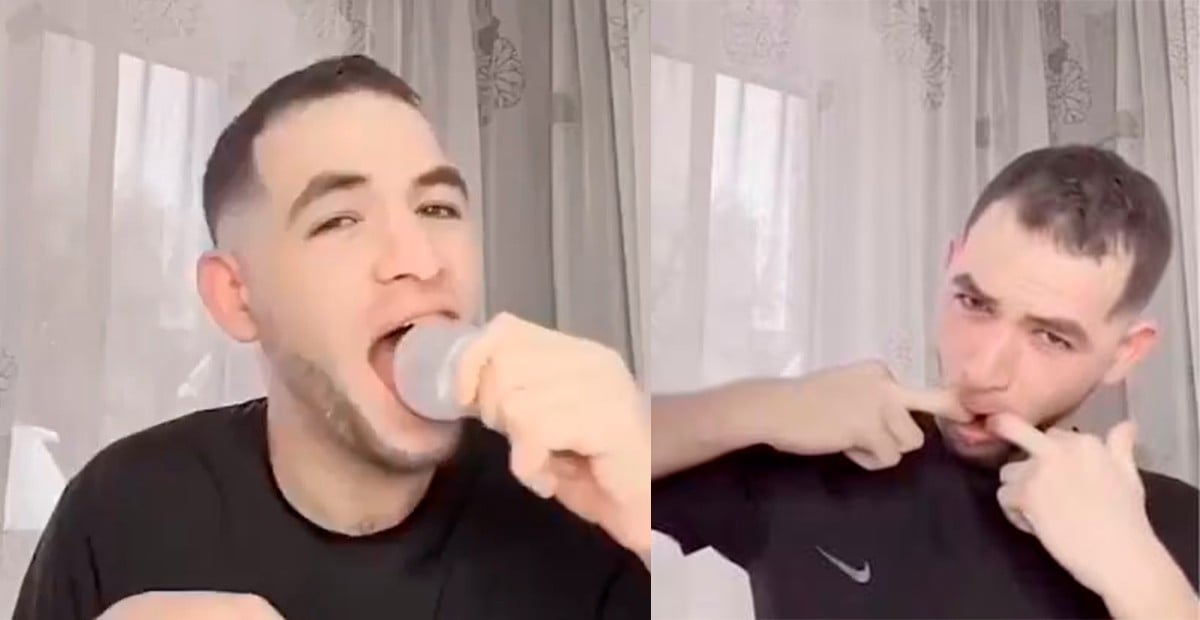 VIDEO Joven se mete un foco en la boca por un reto viral y todo sale mal