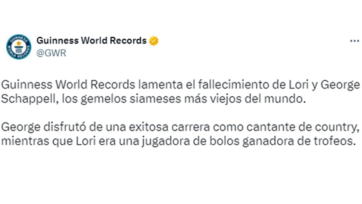 Los gemelos siameses, unidos por la cabeza, más longevos del mundo murieron a los 62 años