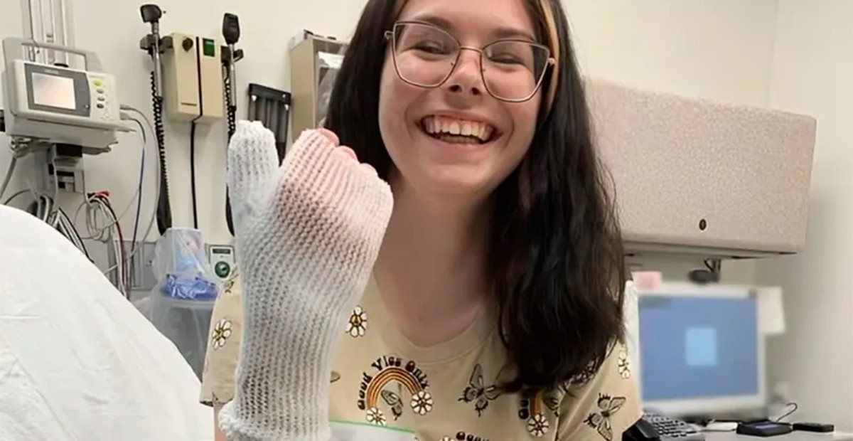 VIDEO Termina con graves quemaduras en su cuerpo por tratar de depilarse con receta de TikTok