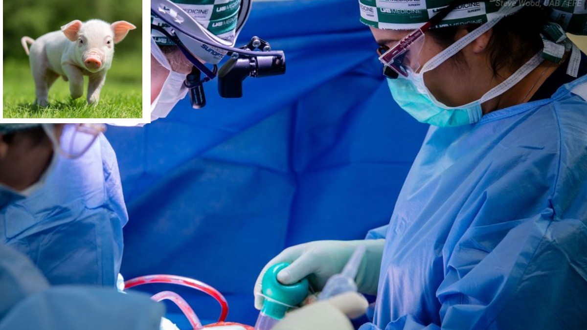 Trasplante de un riñón de cerdo y un corazón mecánico salvan a mujer de muerte segura