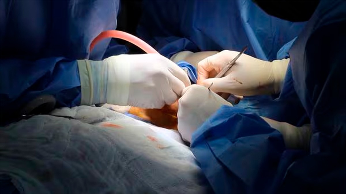 Médicos se llevan una sorpresa, encuentran 150 gusanos en la boca de una paciente