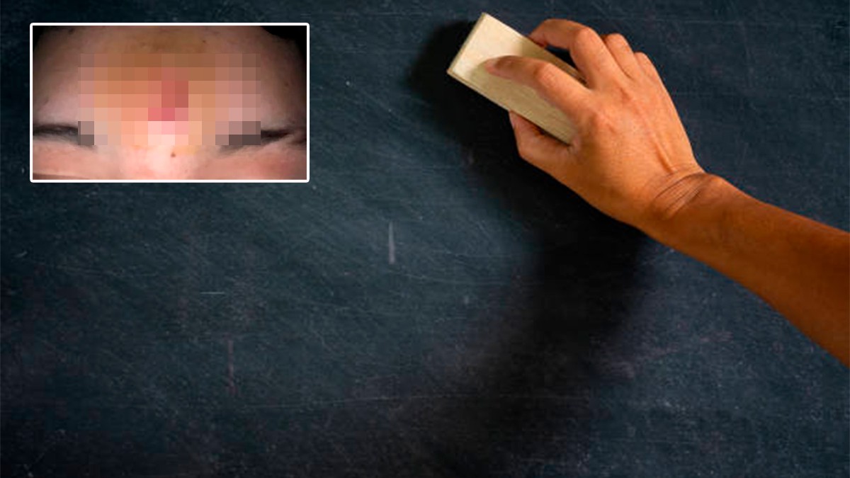 Maestro pierde la paciencia, le avienta borrador a un alumno y lo hiere en la frente