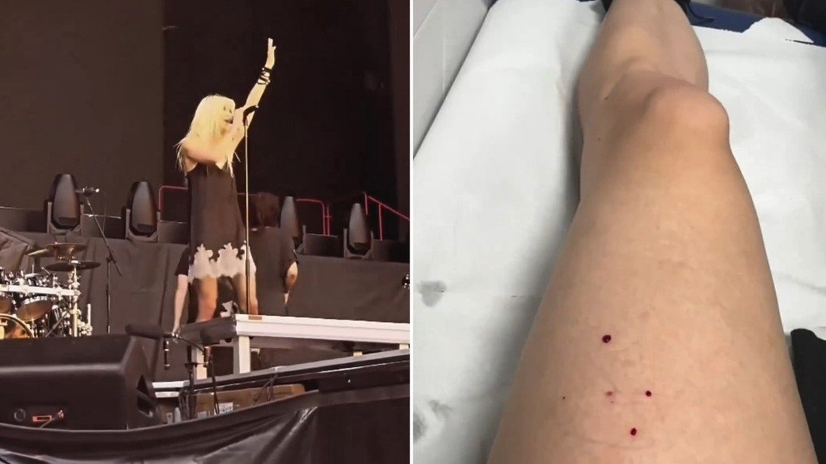 Murciélago muerde a cantante en pleno concierto; ya la tratan por rabia