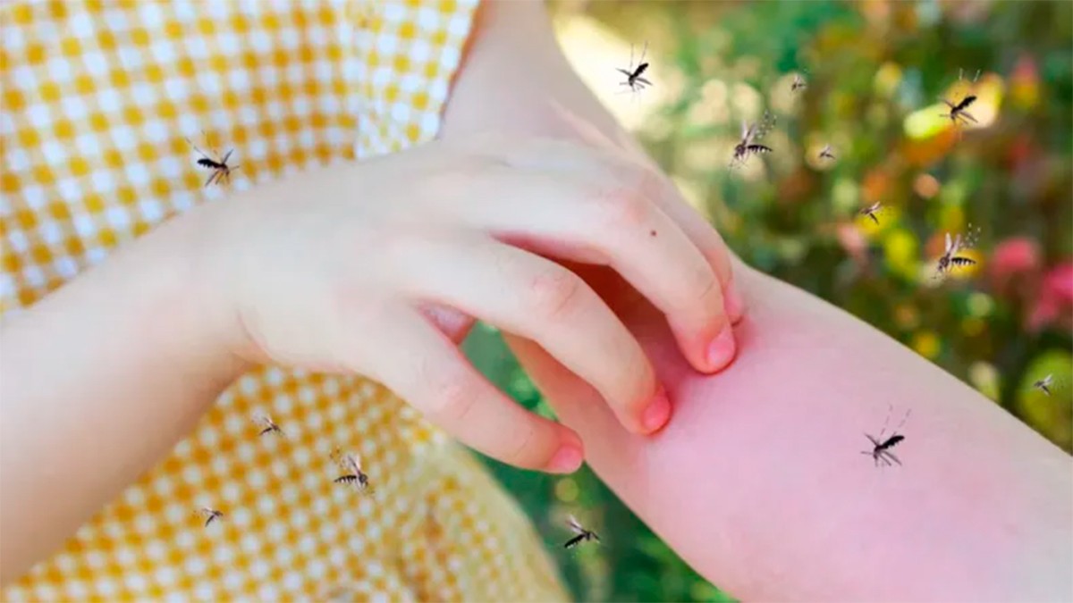 Este es el mejor tip para aliviar la comezón de las picaduras de mosquito